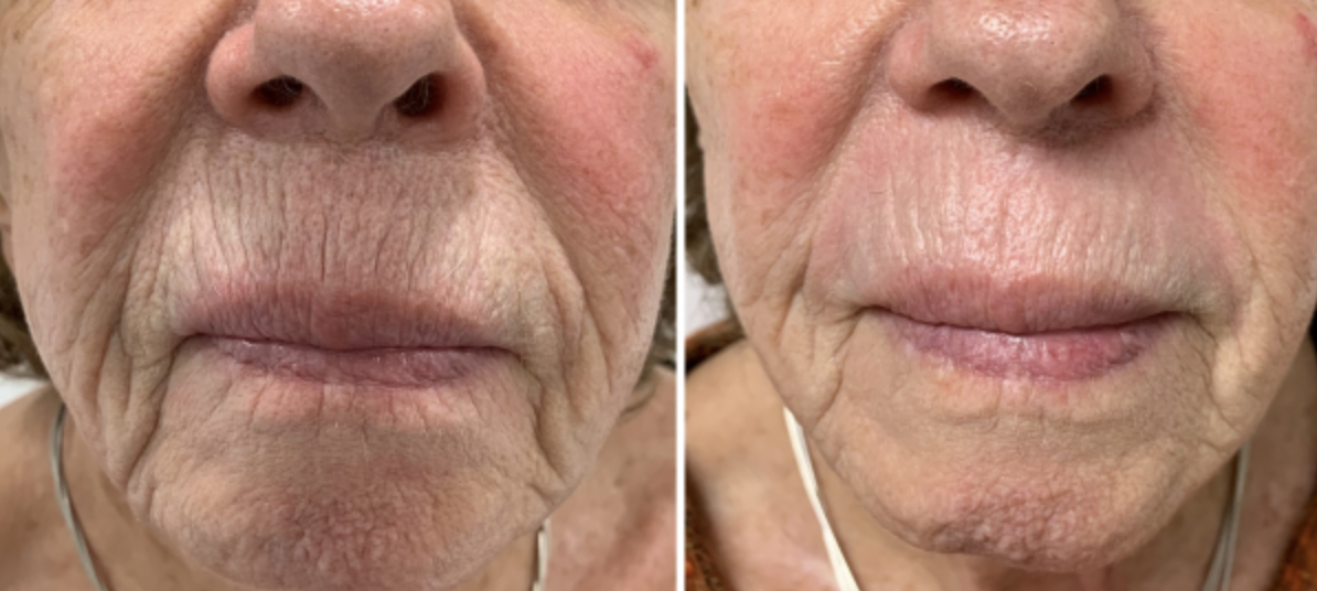 Capture d’écran 2024-12-22 à 16.15.22